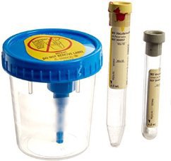 bd-vacutainer-reg-urine-specimen-collection-kit