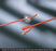 bardex-reg-lubricath-reg-foley-catheter-18-fr-standard