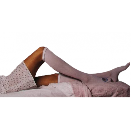 alba-c-a-r-e-trade-anti-embolism-stockings