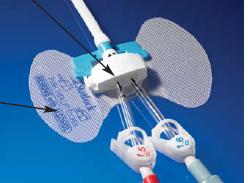 statlock-reg-dialysis-catheter-stabilization-device