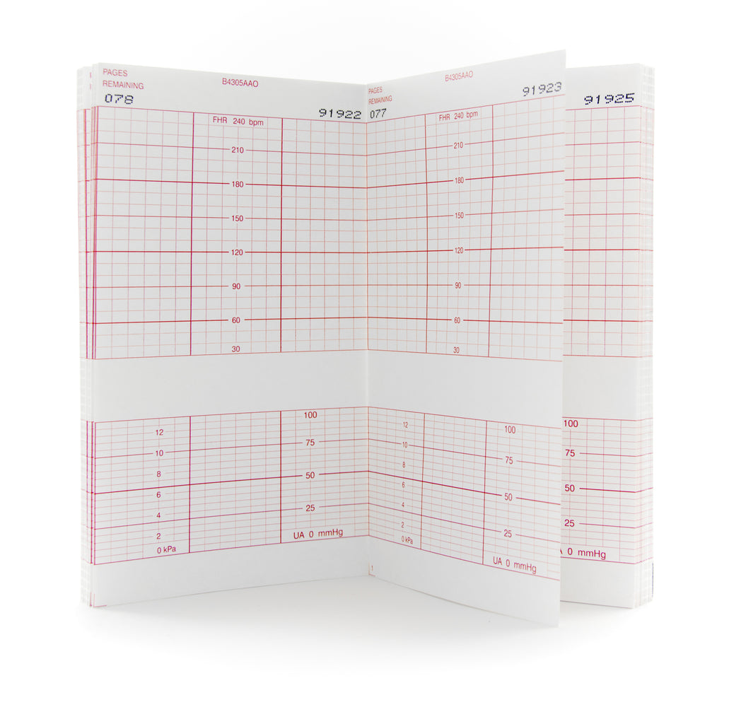mckesson-fetal-monitoring-paper