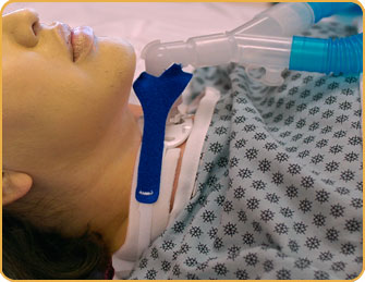 marpac-pediatric-vent-anti-disconnect-circuit