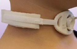 marpac-tracheostomy-tube-collar