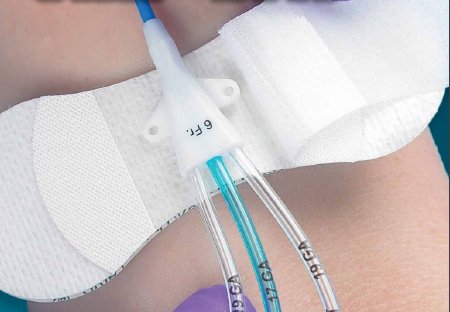 grip-lok-reg-universal-securement-device