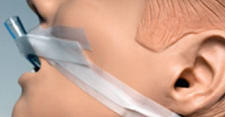 et-adhesive-securement-device