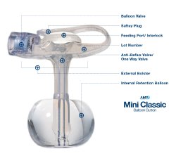amt-mini-classic-balloon-button-gastrostomy-feeding-device