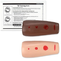 nasco-tb-testing-arm