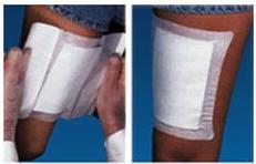woundgard-reg-adhesive-dressing-6-x-8-inch