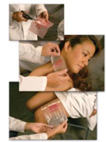 coolmagic-trade-hydrogel-dressing-1-frac34-inch