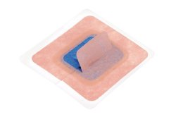 stayfix-reg-catheter-fixation-device-large