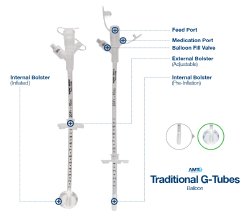 amt-gastrostomy-tube