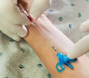 introcan-safety-reg-3-closed-iv-catheter