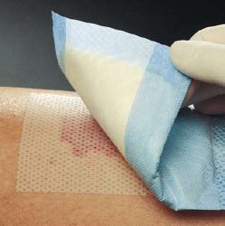 mepitel-reg-wound-dressing-3-x-2-inch