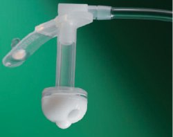 bard-reg-button-gastrostomy-feeding-tube