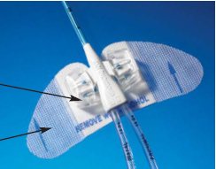 statlock-reg-picc-plus-central-venous-catheter-stabilization-device