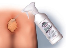 mpm-wound-amp-skin-cleanser-8-oz