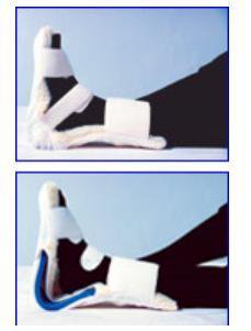 skil-care-trade-foot-drop-boot