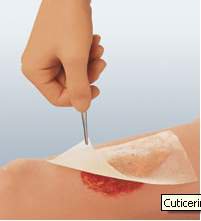 cuticerin-impregnated-dressing-3-x-8-inch